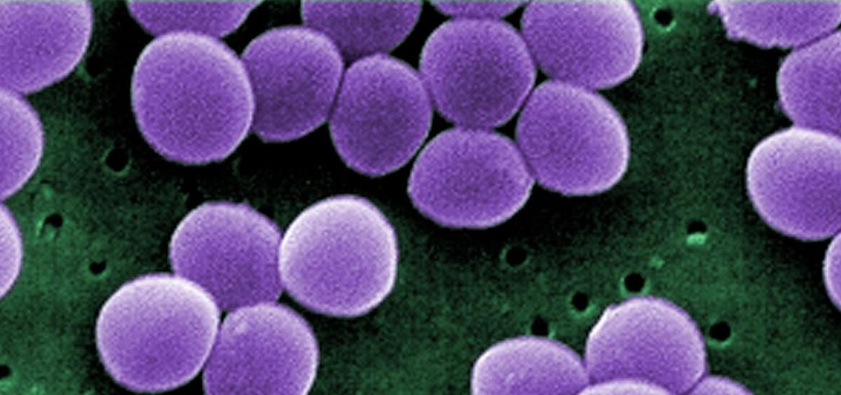 Stahylococcus aureus