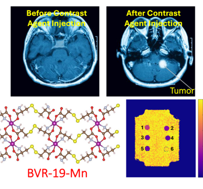 brain scans