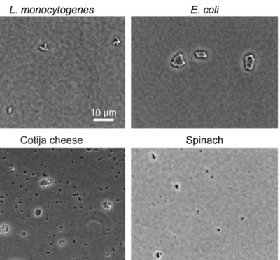 Black and white images comparing microscopic bacteria to microscopic food particles.