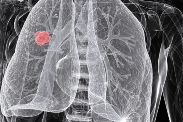 Image of lungs