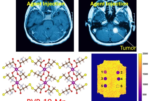 brain scans